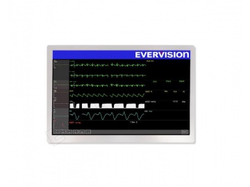 VGG804833-O EVERVISION 7 INCH TFT LCD DISPLAY IPS 800*480 LVDS 30PIN ...
